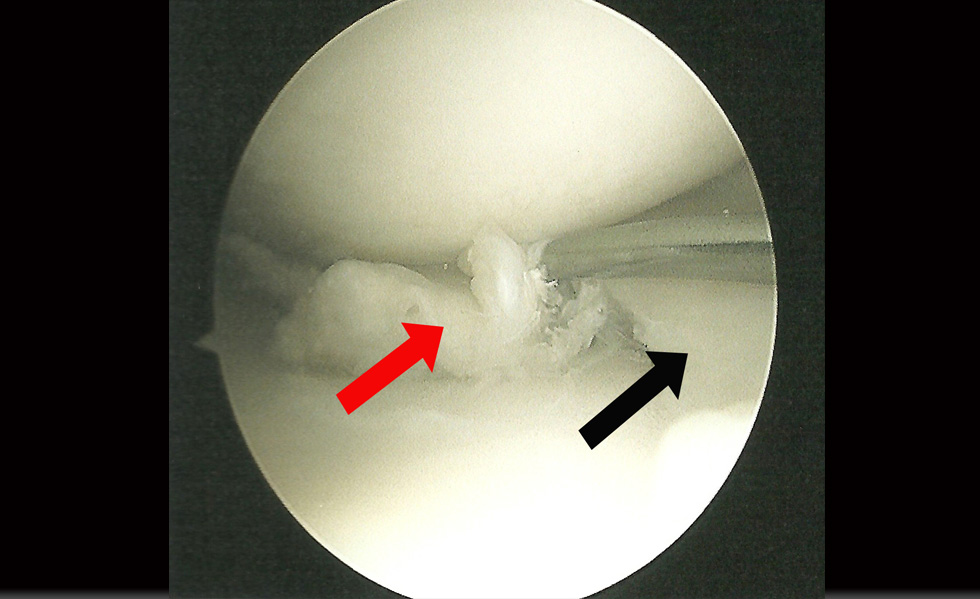 SliderKneeImage5